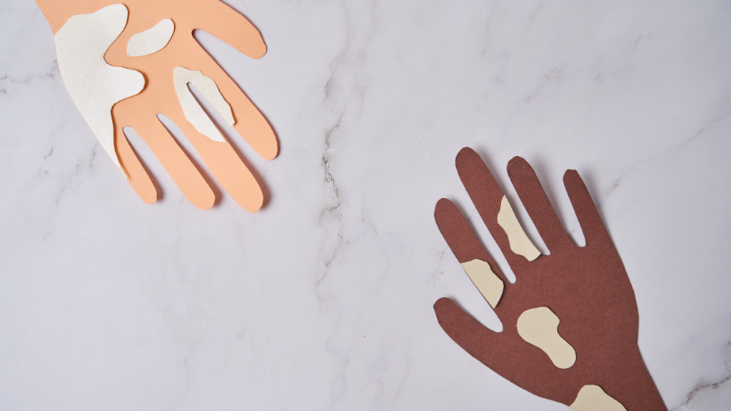 Dépigmentation Cutanée : Entre Mythes et Réalités