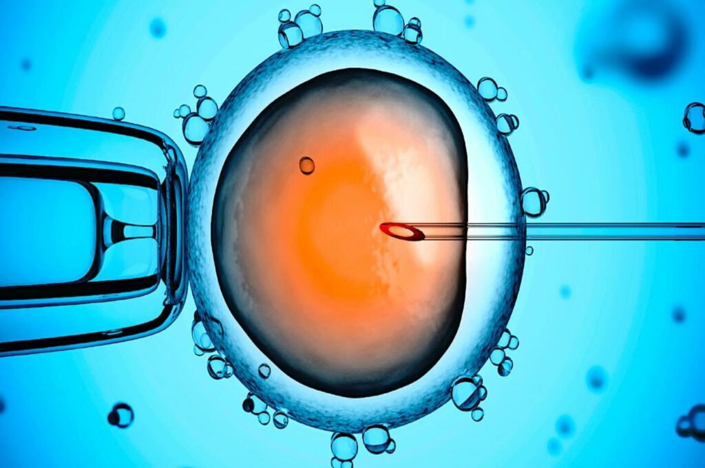 La Fécondation In Vitro