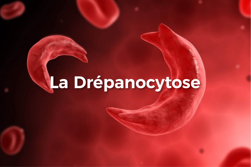 La drépanocytose